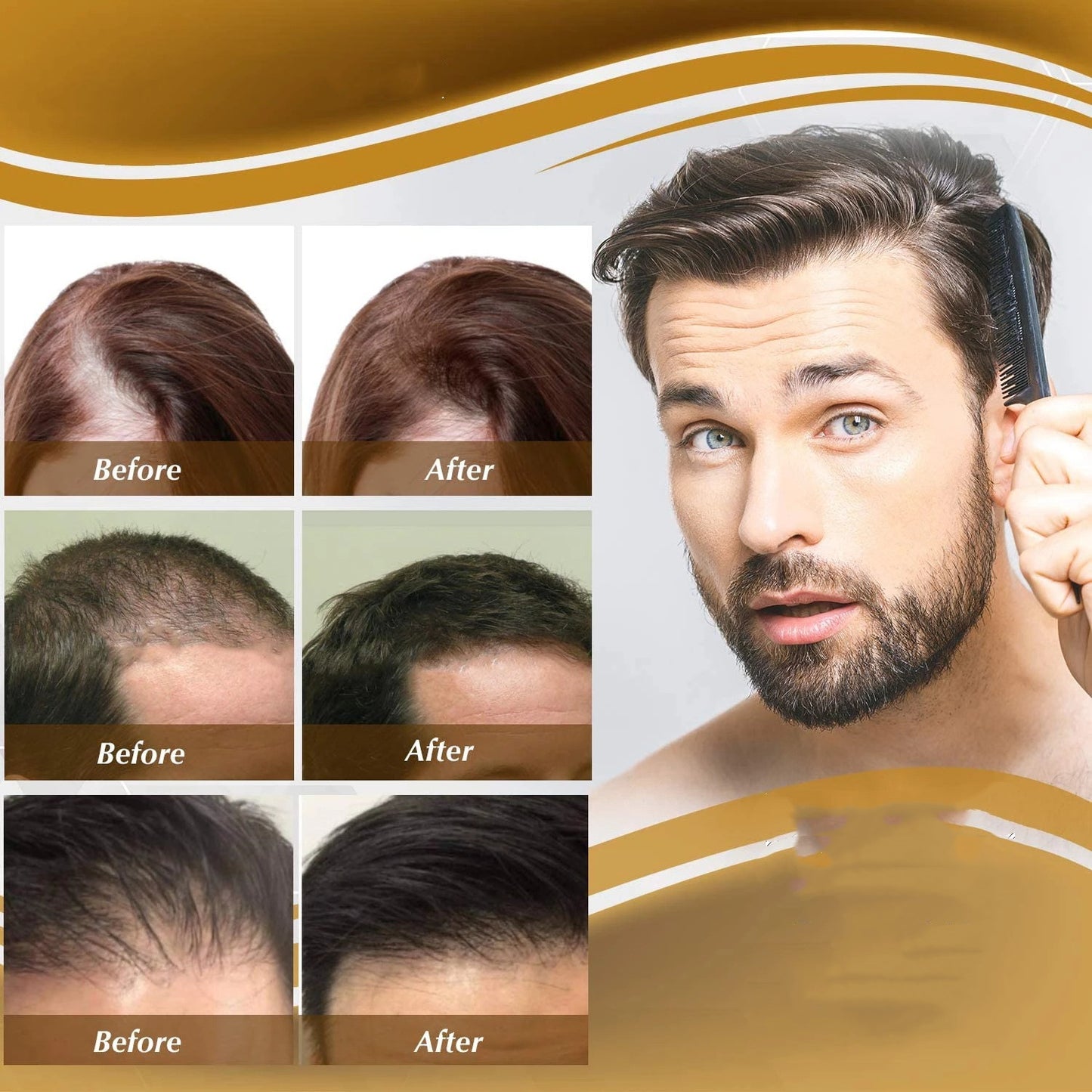 Anti Hair Loss Hair Nourishing Liquid Hair Firming And Hair Increasing Essence